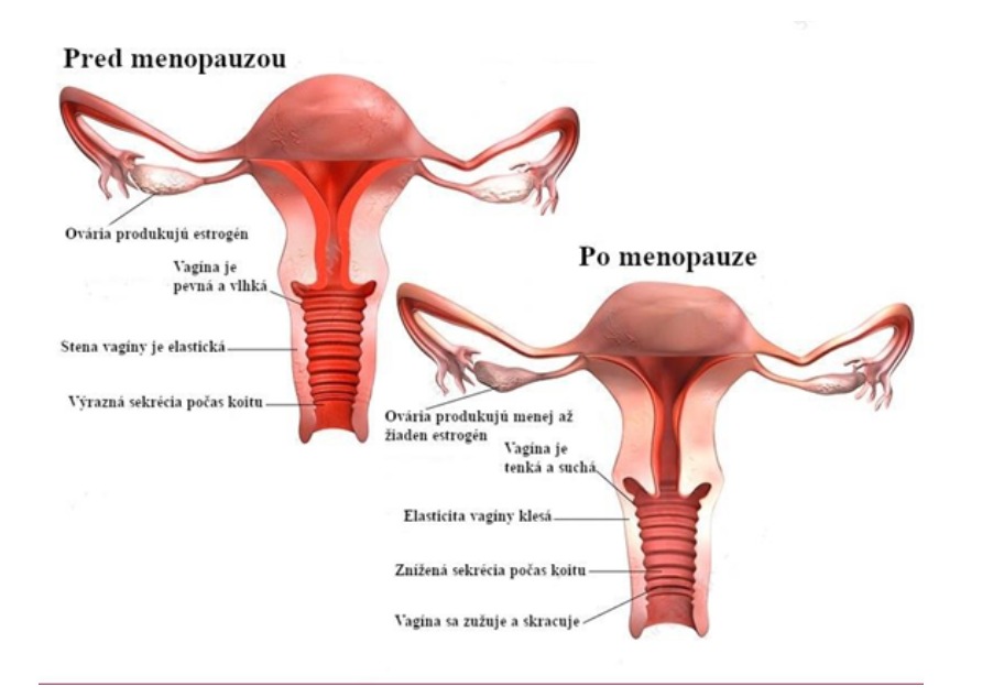 Obr. 2 Anatomické a hormonálne zmeny pred menopauzou a po nej